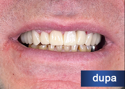 Pacientul înainte de procedură