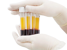 VINDECARE ACCELERATA PRF